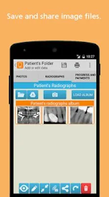 Baixe o Software Dental Cusp DEMO (MOD Grátis) para Android - Captura de tela 3